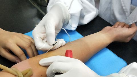 Blood Test Could Revolutionize Detection of Diabetic Vascular Complications