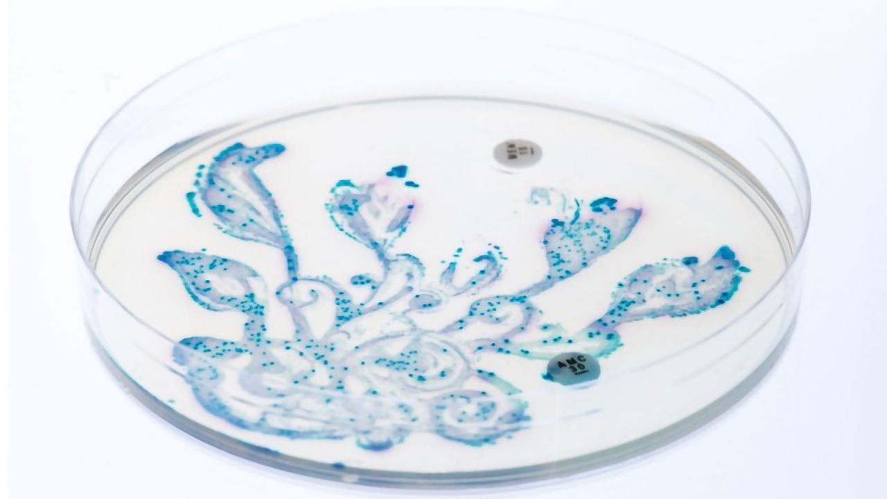 Gut Bacteria “Fingerprint” Can Predict Radiotherapy Side Effects