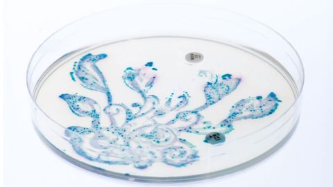 Gut Bacteria “Fingerprint” Can Predict Radiotherapy Side Effects