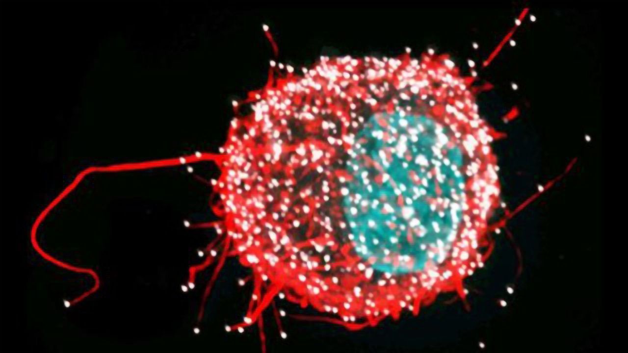 HIV-infected Dendrite