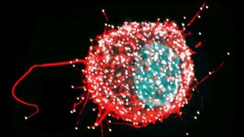 HIV-infected Dendrite