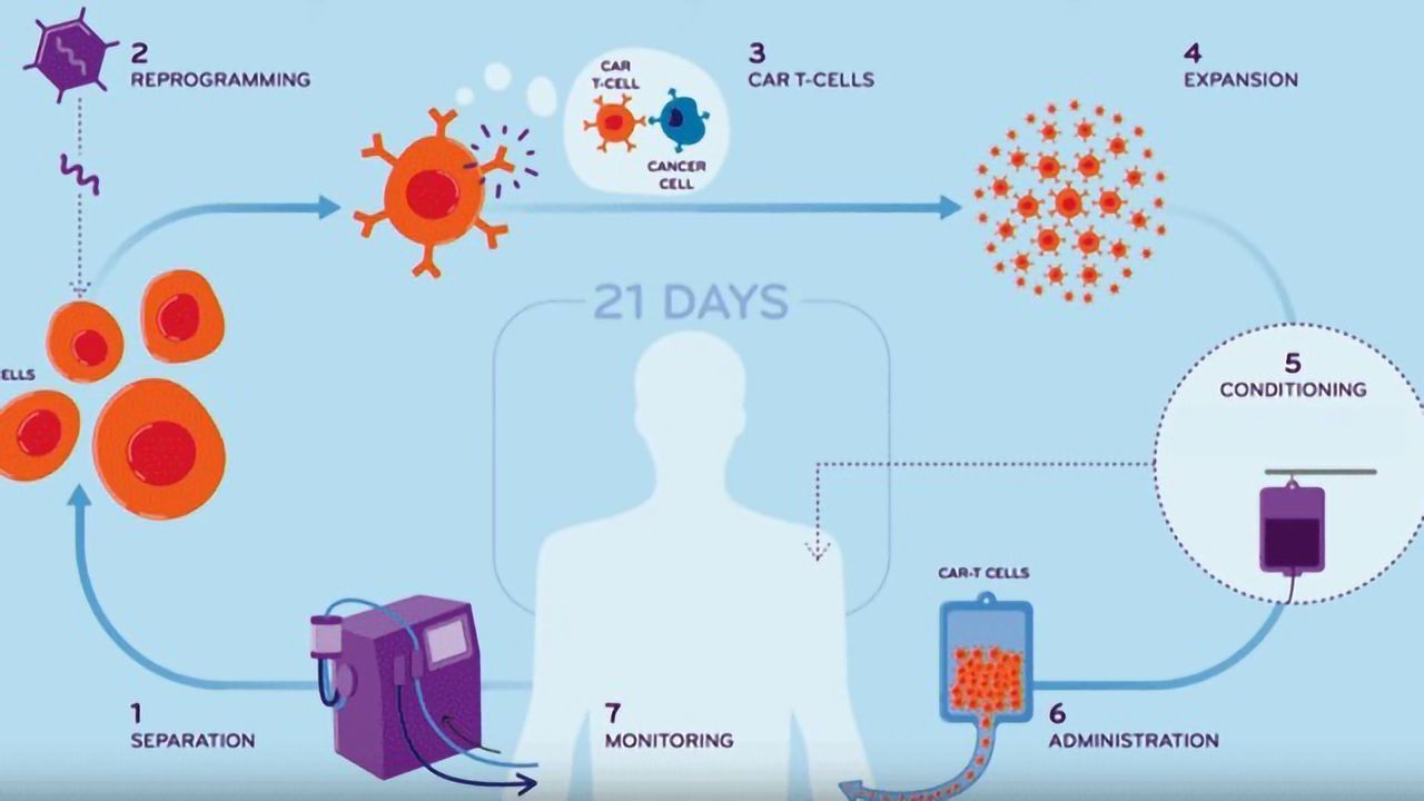 CAR T-cell Therapy: Reprogramming the Immune System To Treat Cancer