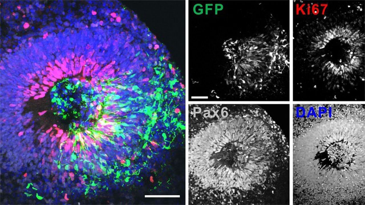 Brain Organoid Research Reignites Ethical Debate