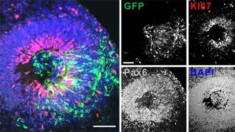 Brain Organoid Research Reignites Ethical Debate