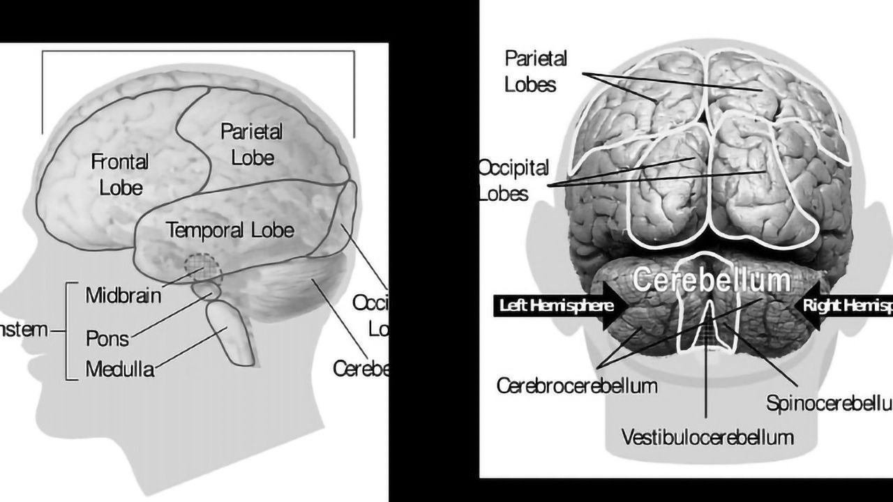 New Study Pinpoints Alzheimer's Plaque Emergence Early and Deep in the Brain