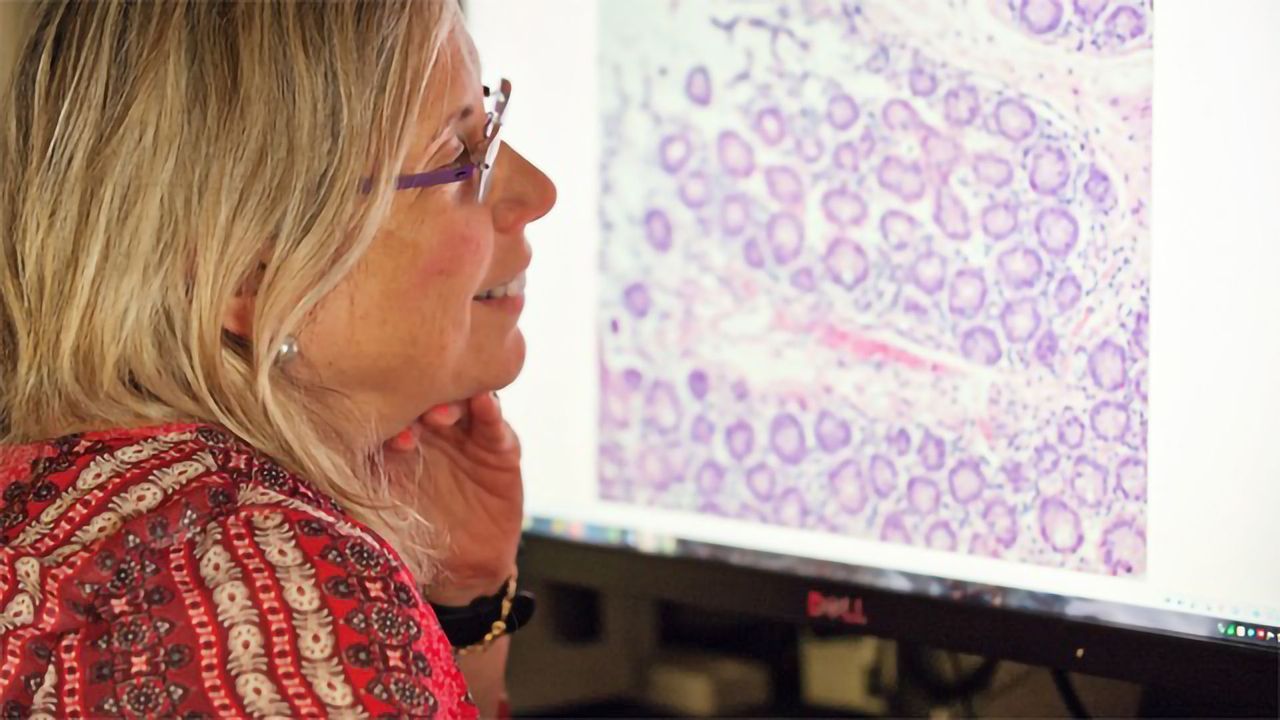 Aggressive Breast Cancers Hoard Energy, Enabling Them to Spread