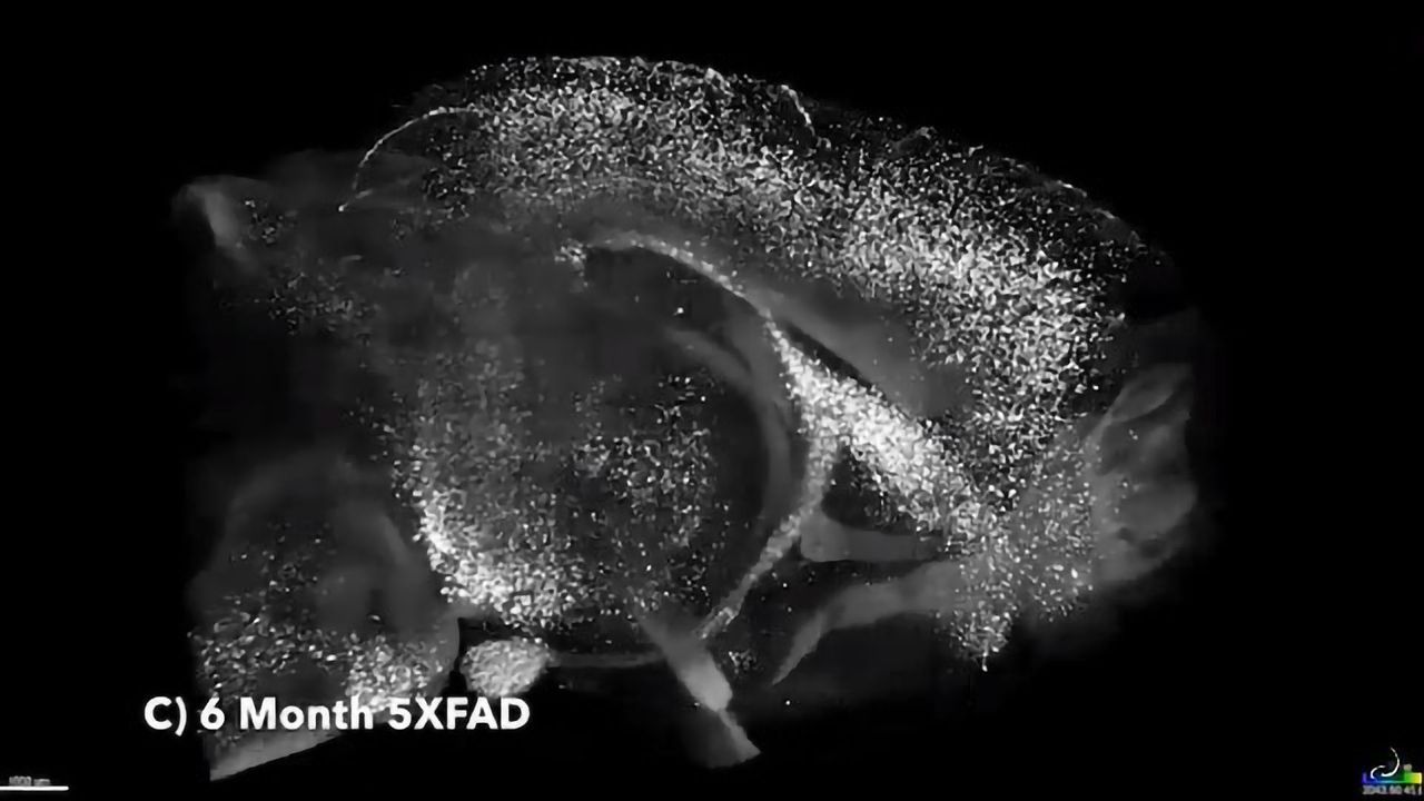 The Deep Brain Origins of Alzheimer's Disease