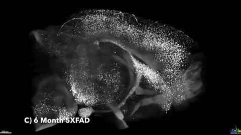 The Deep Brain Origins of Alzheimer's Disease