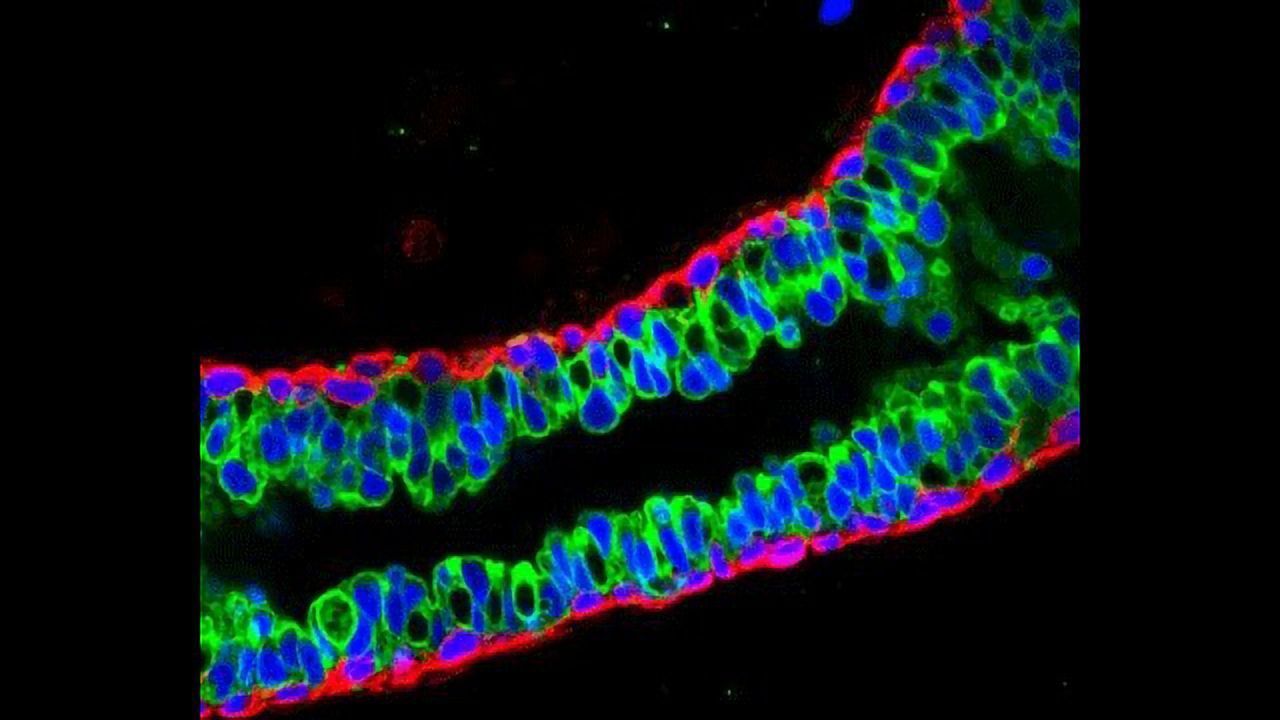 Better Understanding Cancer by Mapping Normal Breast Development