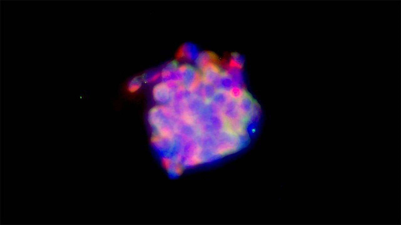 Targeting Tumor-initiating Liver Cancer Cells