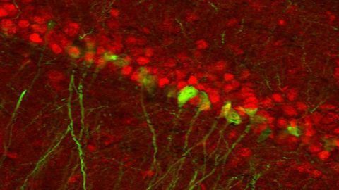 A Gender-distinct Circuit for Depression?