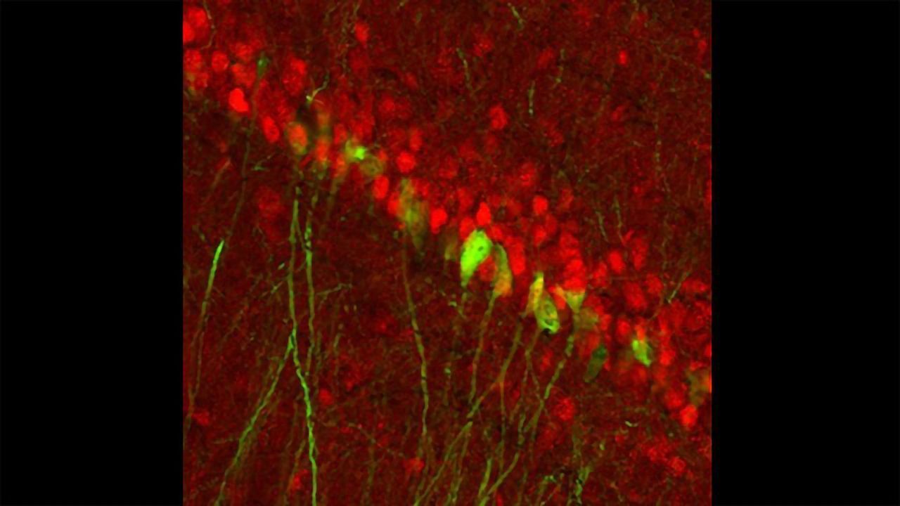 Gender-distinct Circuit for Depression