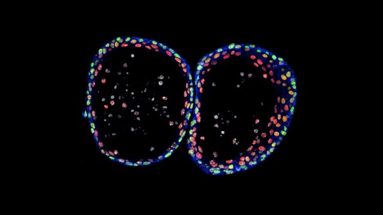 Urothelial Organoids