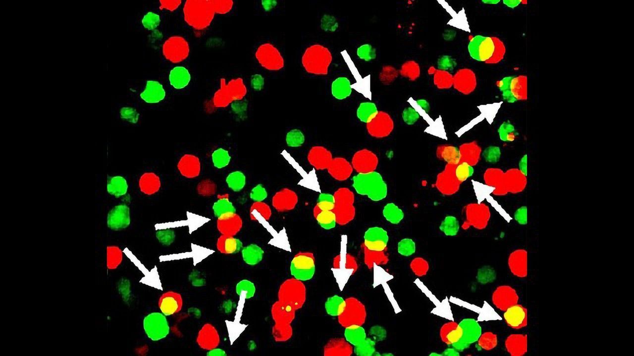 “Sticky” Gene Could Help Valium Calm Nerves