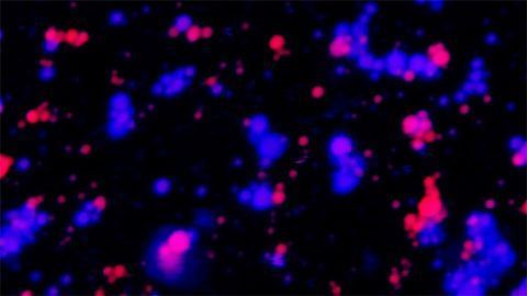 How Can Liquid Organelles in Cells Coexist Without Merging?