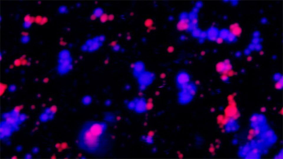 How Can Liquid Organelles in Cells Coexist Without Merging? content piece image