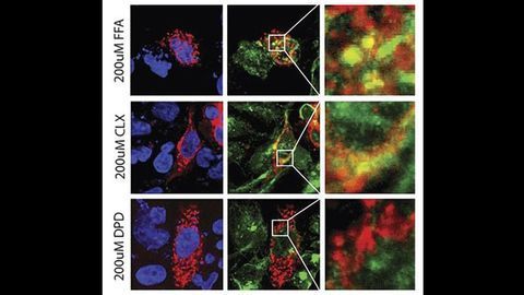 Novel Drugs Could Improve Long-term Treatment of Poorly Controlled Asthma