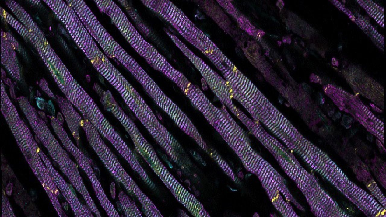 Reducing Heart Attack-induced Tissue Damage by 30%