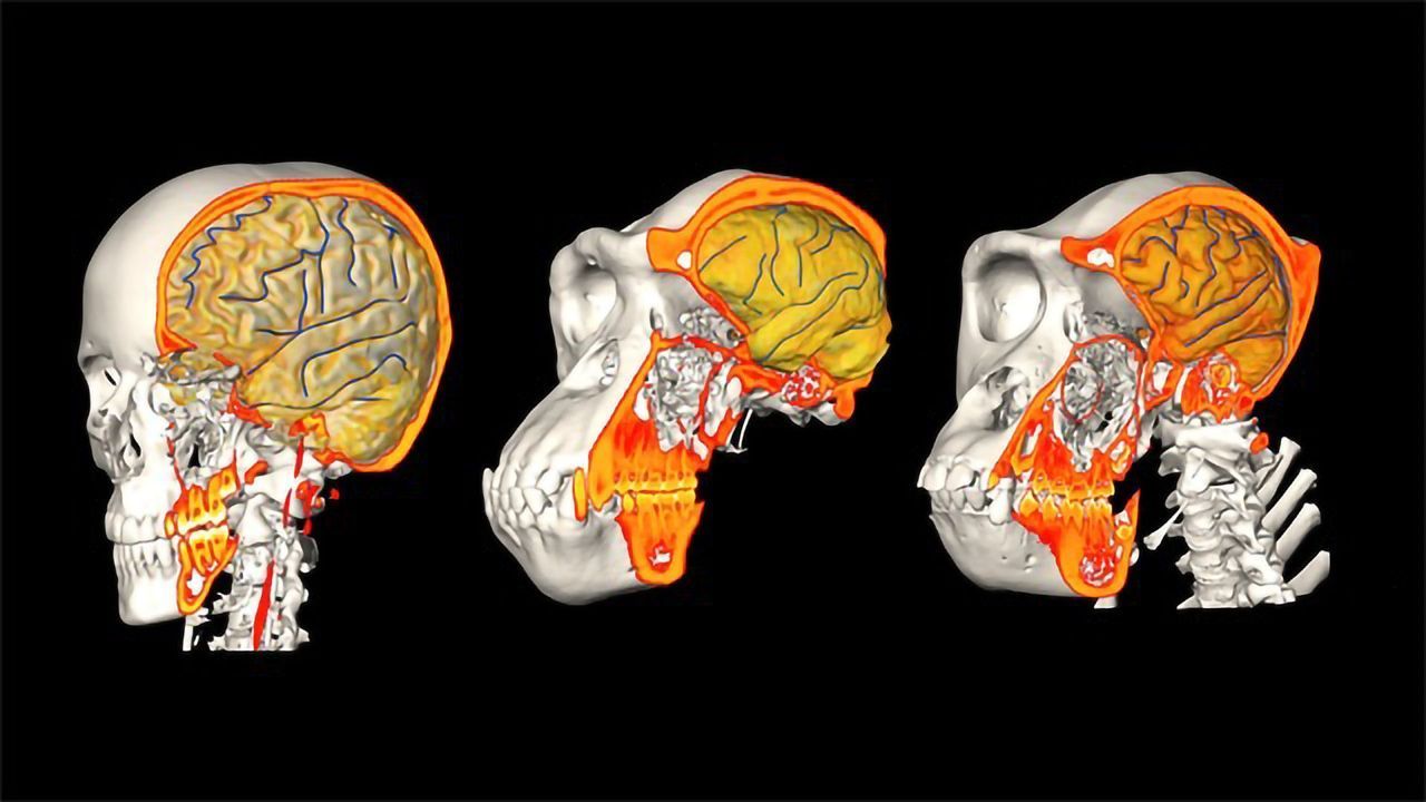 Why Are Human Brains So Big?