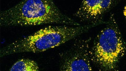 Plant-based Compound Helps Overcome Gene Therapy Challenges