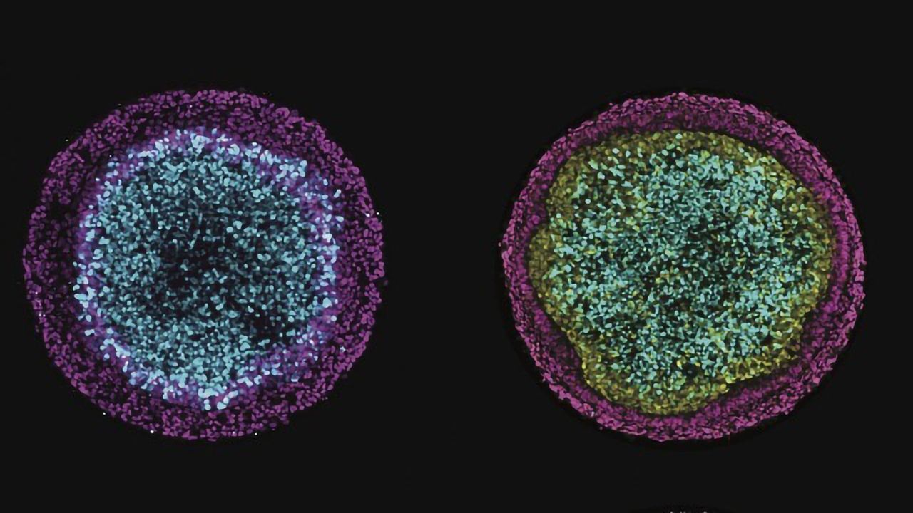 Embryo’s Early Development Revealed in a Dish