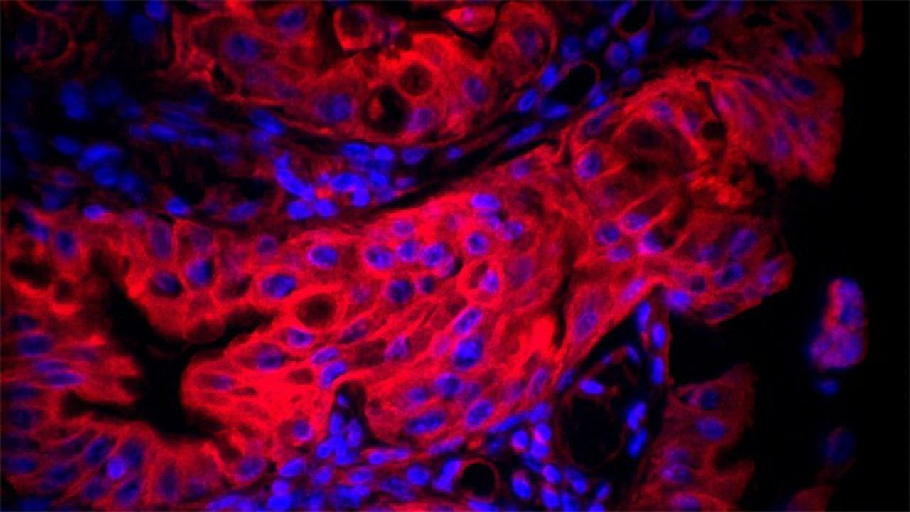 Combatting Superbugs With Nanocapsules