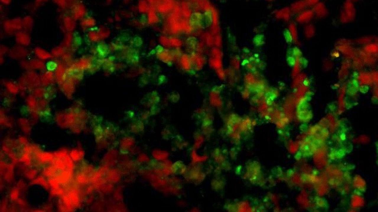 Compound Kills Chemotherapy-resistant Cancer Cells