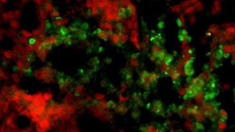 Compound Kills Chemotherapy-resistant Cancer Cells
