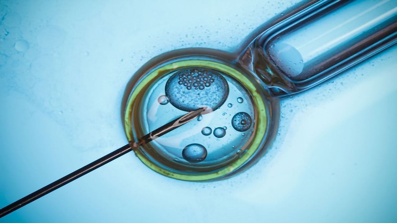 Analyzing Sperm DNA Damage To Diagnose Male Infertility