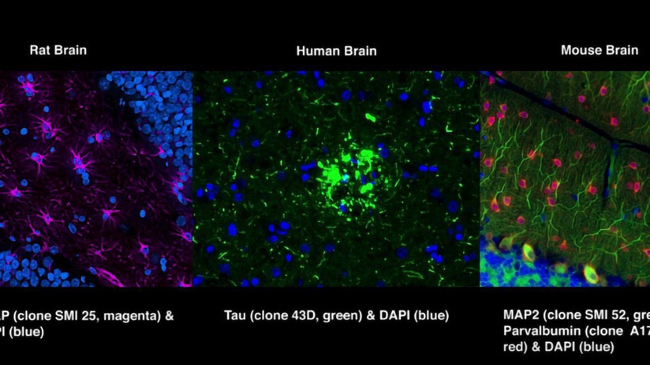 Immunofluorescence tissue staining