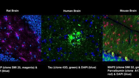 Immunofluorescence tissue staining