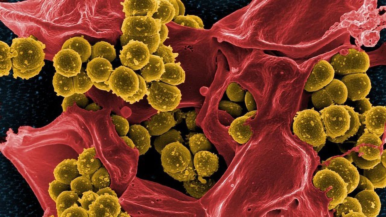 Researchers Discover First Clues on How Gut Health Influences Brain Health