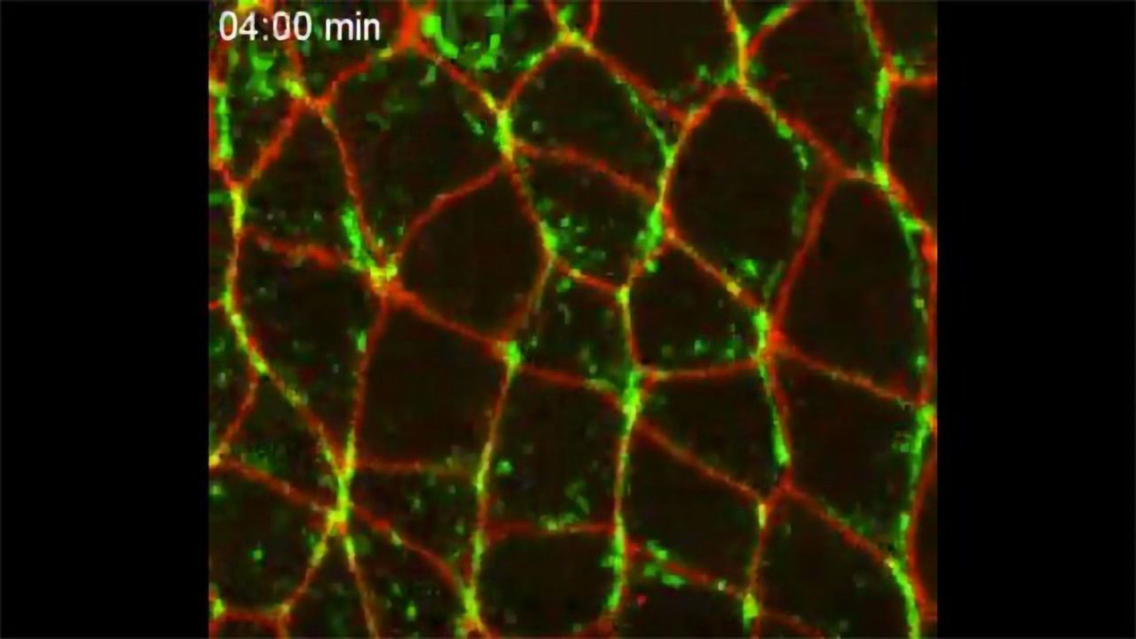 In Vivo Imaging Shines Light on MYH9 Gene's Role in Human Disorders
