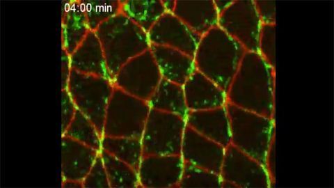 In Vivo Imaging Shines Light on MYH9 Gene's Role in Human Disorders