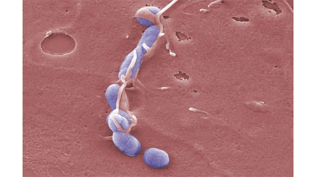 Tool Could Help Identify Yersinia Strains and Estimate Their Pathogenicity