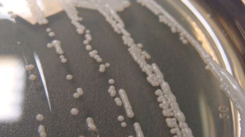 Faster Identification of Bacterial Infections Using Raman Spectroscopy