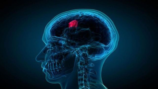 A Blood Test Can Predict Brain Cancer Prognosis content piece image 