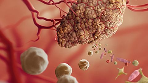 Enrichment of Human Carcinoma Cells for Sensitive Molecular Analysis