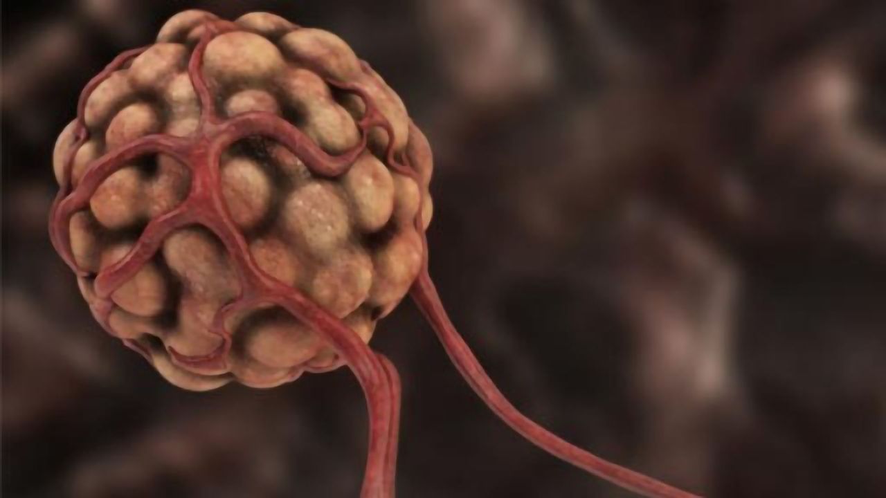 Tumors Transform Gut “Brain Cells” Into Tumor Growth Promoters