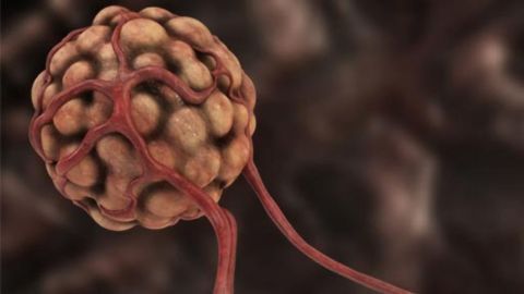 Tumors Transform Gut “Brain Cells” Into Tumor Growth Promoters