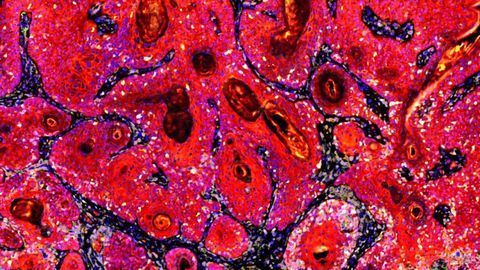 Immune Response Against Skin-dwelling Viruses Stops Cancer