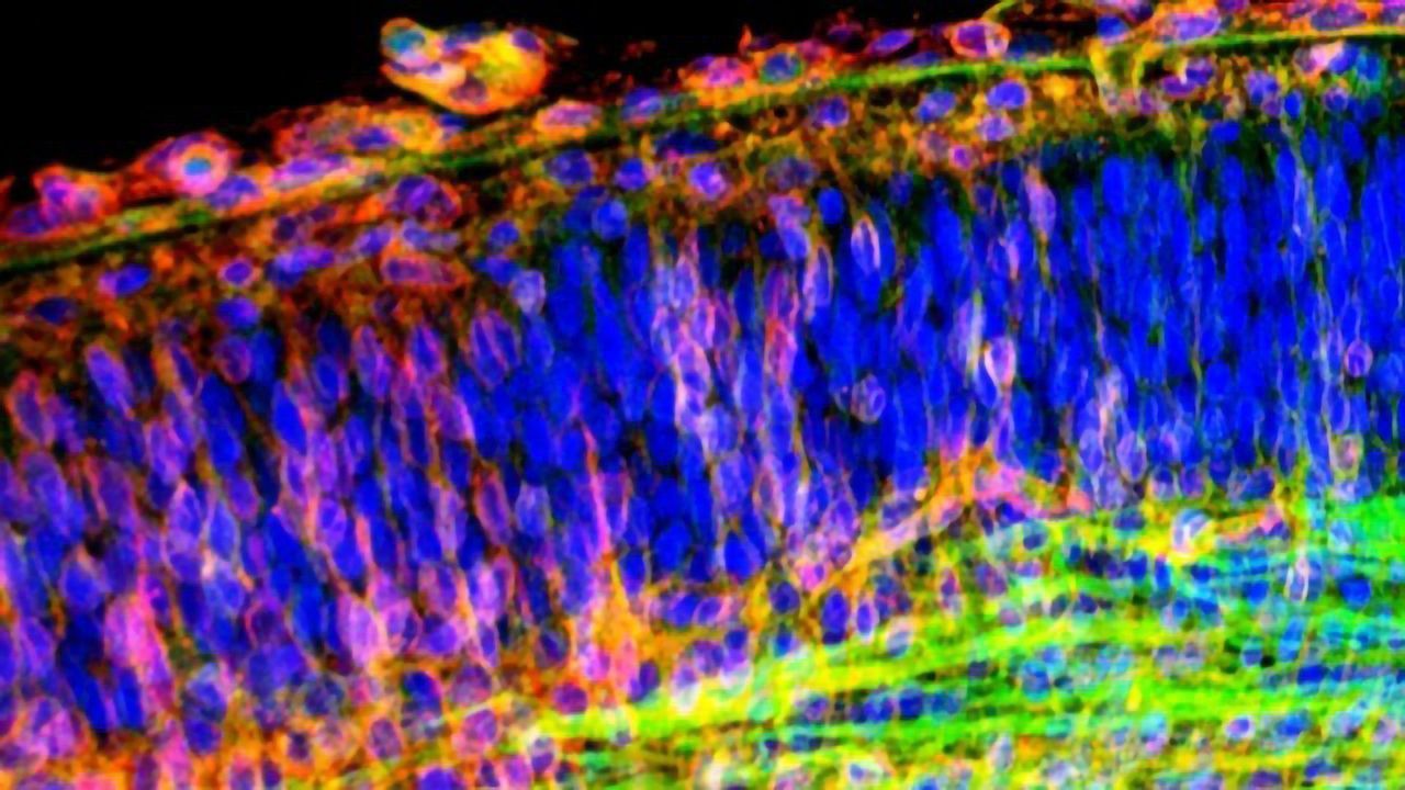 Key Gene in Familial Alzheimer's Disease Regulates Neuronal Development