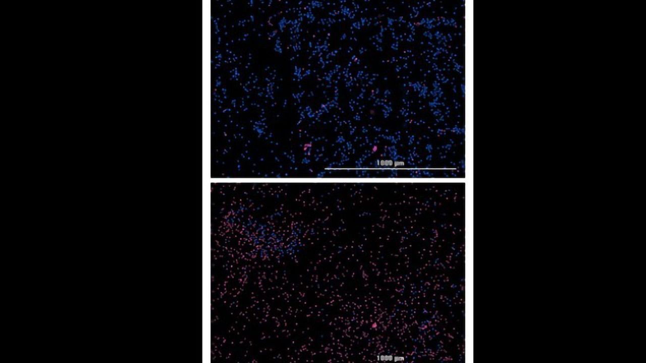 Drug Compound "Cocktail" Proves Toxic to Leukemia Cells