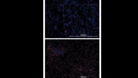 Drug Compound "Cocktail" Proves Toxic to Leukemia Cells