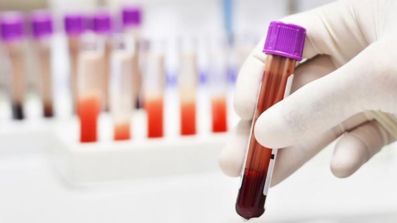 Simple Blood Test for Early Detection of Breast Cancer