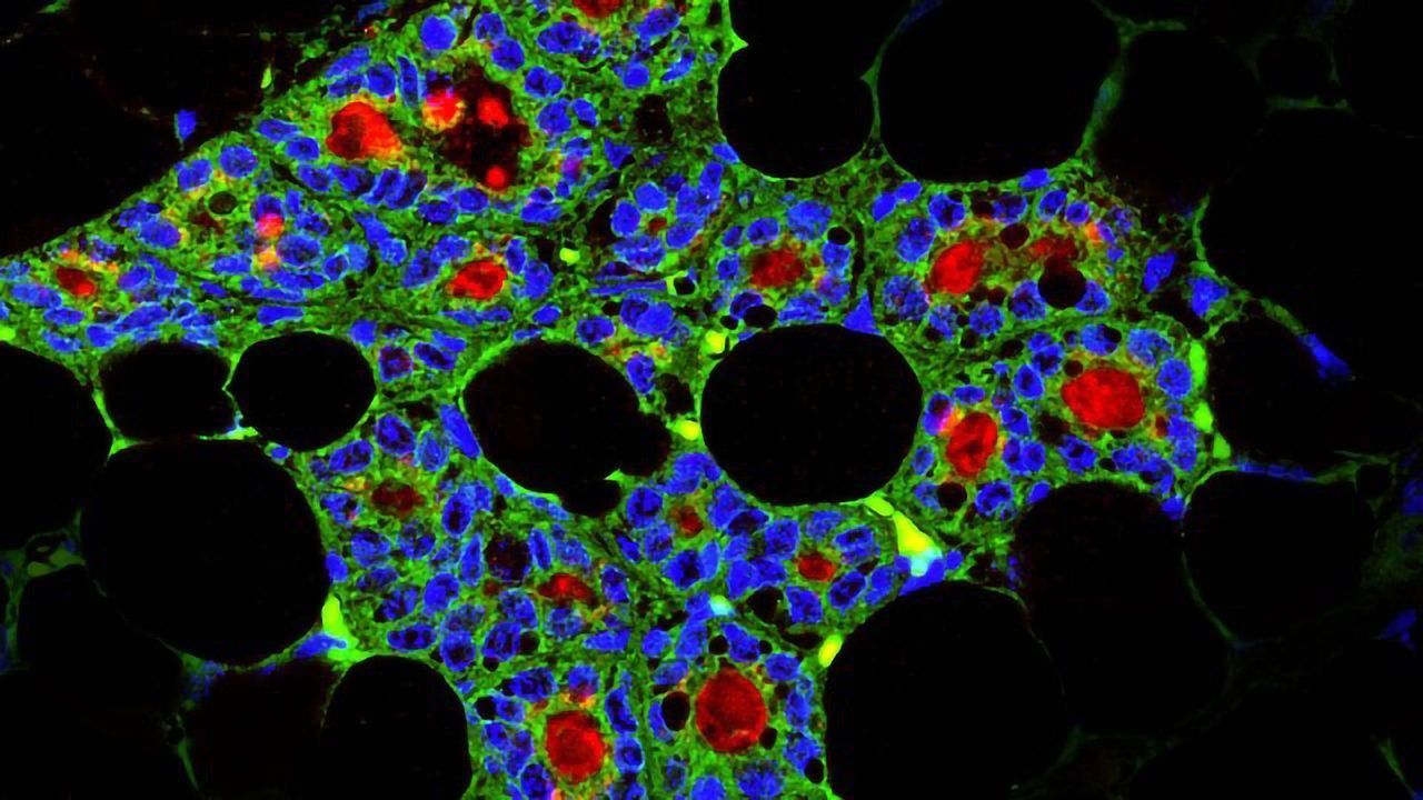 Milk From Teeth: Dental Stem Cells Can Generate Milk-Producing Cells