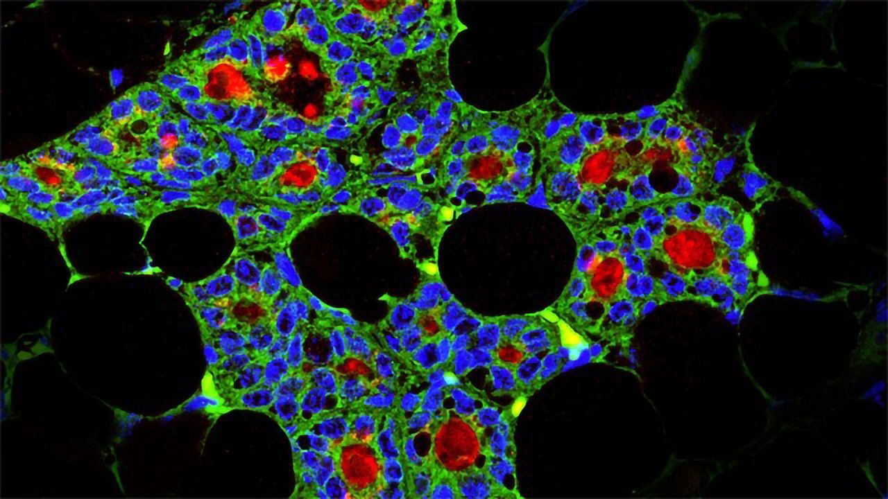 Using Dental Stem Cells to Regenerate Mammary Glands
