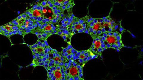 Using Dental Stem Cells to Regenerate Mammary Glands