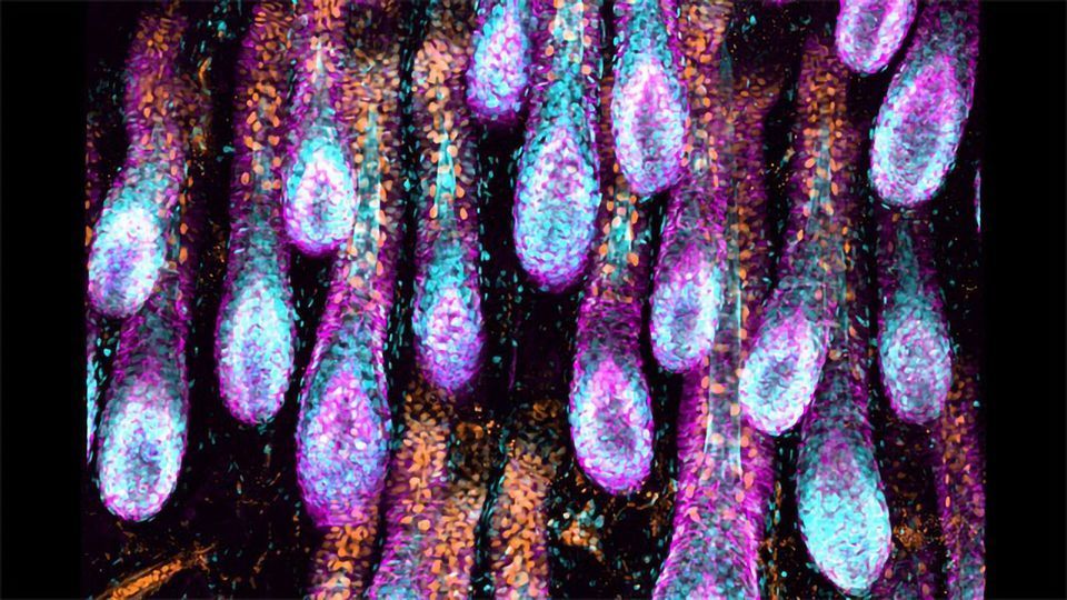 Lymphatic System Discovered To Play Key Role in Hair Regeneration content piece image