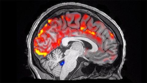 Are We "Brainwashed" During Sleep?